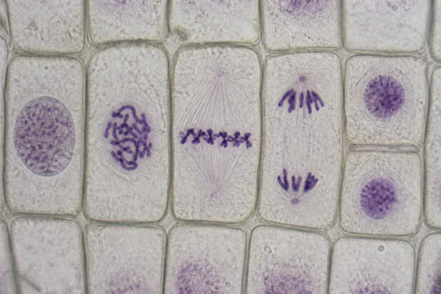 Cinco aspectos microscópicos de células vegetales: núcleo con cromatina difusa, cromosomas condensados, cromosomas alineados en el ecuador, dos grupos separados hacia polos y dos núcleos hijos.